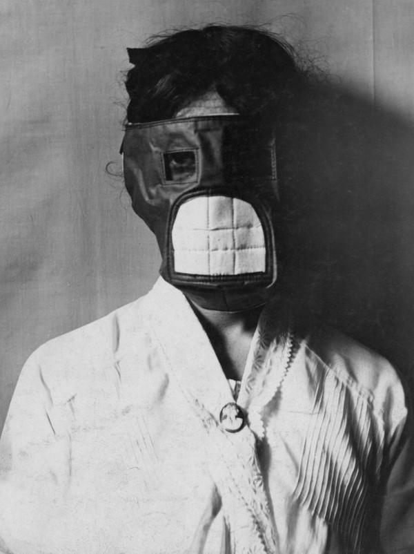 一張照片看歷史：第一次世界大戰中的軍事科技