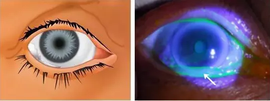 這層“面板”長了“皺紋”惹來了老淚縱橫