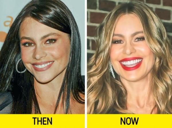 10位標誌性的名人幾十年後的樣子,歲月就像把殺豬刀啊 10位標誌性的名人幾十年後的樣子,歲月就像把殺豬刀啊