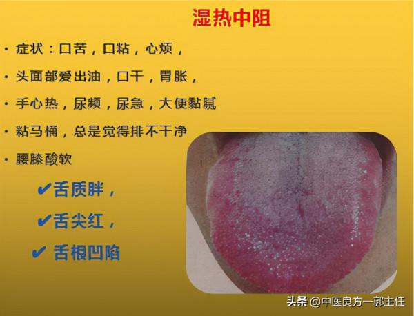 12種“熱”藏於體內,反應的舌象、症狀各不相同,自查便知 12種“熱”藏於體內,反應的舌象、症狀各不相同,自查便知