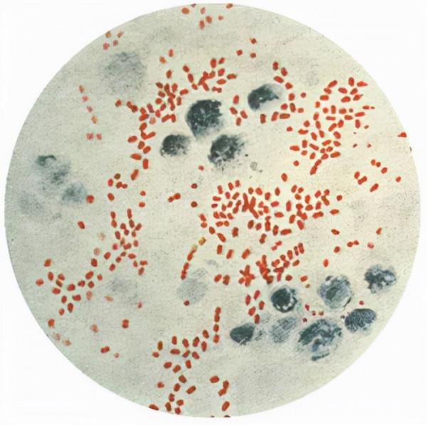 一起獨一無二的案件!印度富家公子手臂被刺一下就死了 一起獨一無二的案件!印度富家公子手臂被刺一下就死了