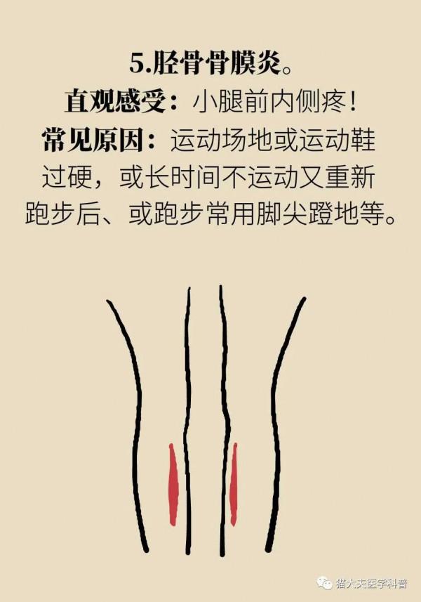 姿勢不對會引起5種損傷！你的跑步姿勢正確嗎？