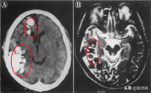 醉蟹吃過嗎?如果你食用的是這種醉蟹,醫生提醒最好去醫院檢查下 醉蟹吃過嗎?如果你食用的是這種醉蟹,醫生提醒最好去醫院檢查下