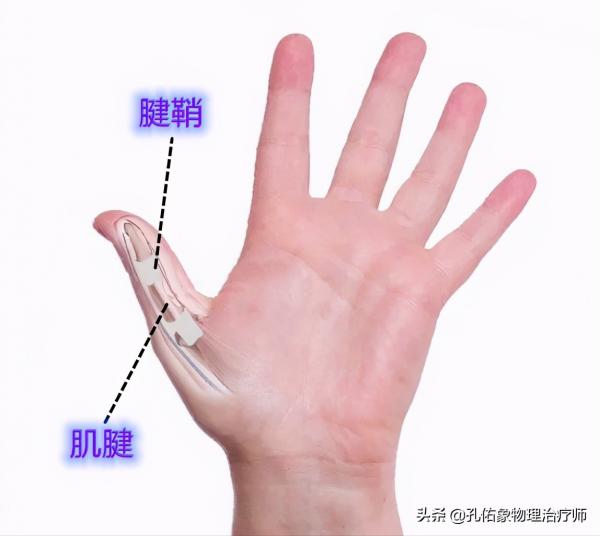 50歲左右的中老年人，手指僵硬、疼痛、怕冷、變形，預示哪些疾病