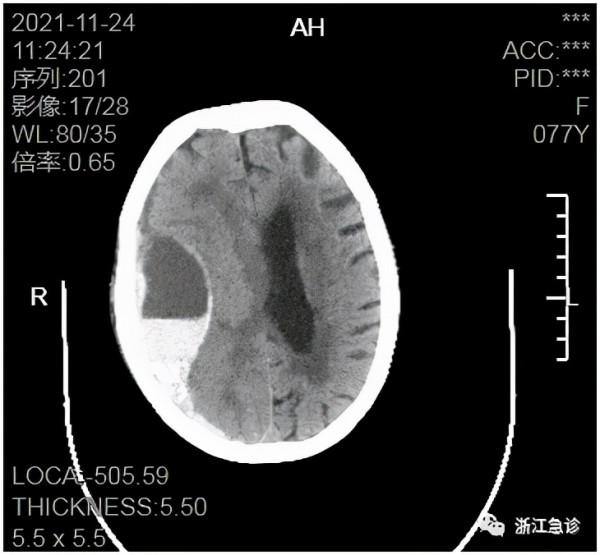 “正常”的心率背後也可能隱藏著危險，體溫脈搏呼吸血壓你真的讀懂了嗎？