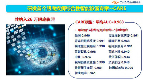 視網膜AI落地應用按下“加速鍵” 視網膜AI落地應用按下“加速鍵”