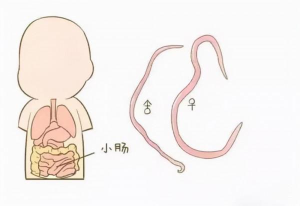 幾十年前,幾乎人人肚子裡都有的蛔蟲,為何現在沒有人聽說過了? 幾十年前,幾乎人人肚子裡都有的蛔蟲,為何現在沒有人聽說過了?