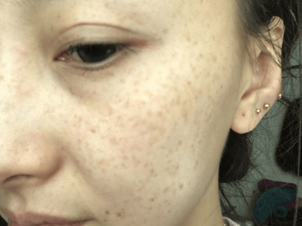 每天都喝綠豆湯，對面板有什麼效果？醫生：若想變白，需做3件事