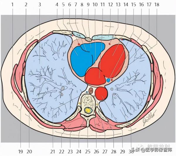 CT斷層解剖圖譜最全總結「推薦收藏」 CT斷層解剖圖譜最全總結「推薦收藏」