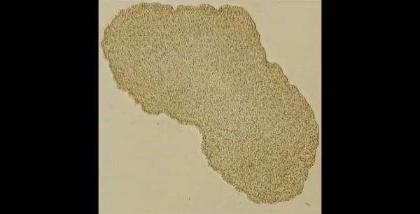 「PLOS Biology」它的天生抗癌能力能否造福人類？從物種進化中尋找治療癌症的新方法