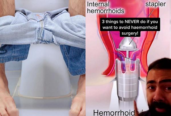 英國醫生建議：上廁所最好不要超過10分鐘，如果你想避免手術的話