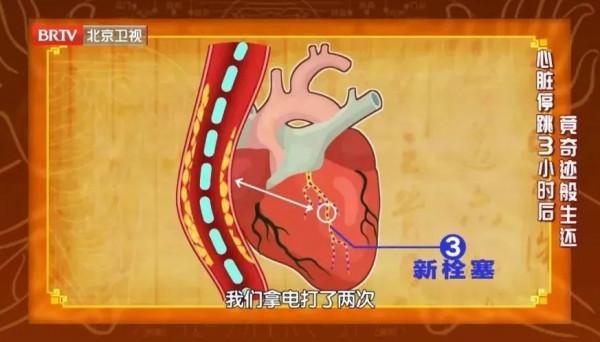 早晨醒來,第一件事竟然不是急著起床?院長分享3大“法寶”,護血管、強心臟,冬天尤其適用 早晨醒來,第一件事竟然不是急著起床?院長分享3大“法寶”,護血管、強心臟,冬天尤其適用