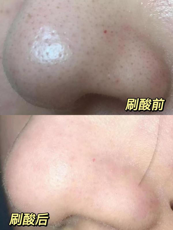 終於學會了這個護膚小技巧