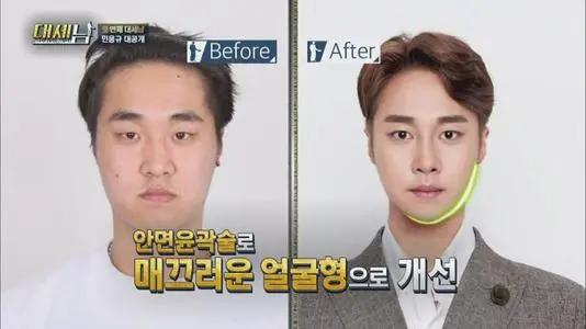 宋智雅當選韓國top長相,但其實是下等臉? 宋智雅當選韓國top長相,但其實是下等臉?