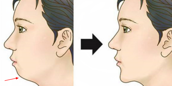 “假臉”大比拼?薛之謙變化大、羅志祥五官前後對比驚人 “假臉”大比拼?薛之謙變化大、羅志祥五官前後對比驚人