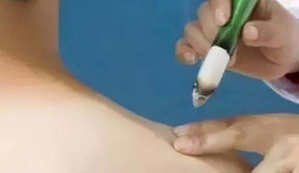 55歲肩周炎患者，疼痛難忍、屈伸不利？巧用這幾個穴位，輕鬆緩解