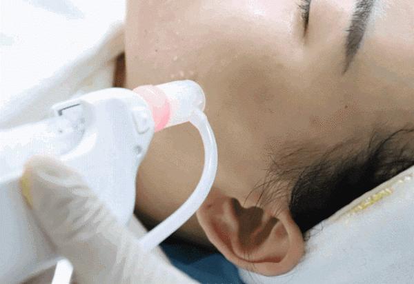 別拿寶貴的臉去“試錯”,醫美專案得這麼選(醫生經驗總結) 別拿寶貴的臉去“試錯”,醫美專案得這麼選(醫生經驗總結)