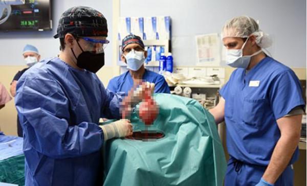 天目Tech+豬心臟移植到患者身上？心臟外科專家：意義重大