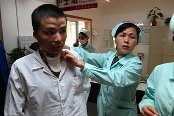 11年前,那個探親中途浴火救44人,全身90%燒傷的子弟兵,現況如何