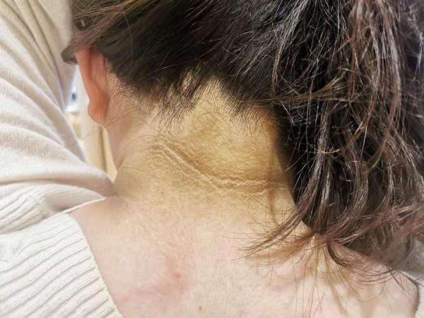 體內有癌，脖子先知？頸部若出現3種異常，可能是癌症在靠近
