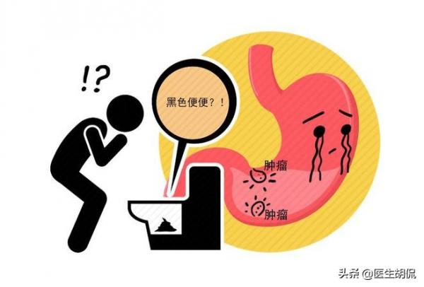 是胃癌,還是胃炎,傻傻分不清!醫生介紹:看好幾點,別再混淆 是胃癌,還是胃炎,傻傻分不清!醫生介紹:看好幾點,別再混淆