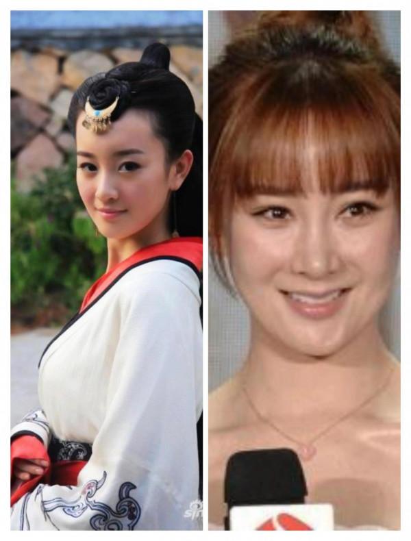 整容整毀的女星 整容整毀的女星