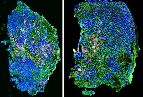 按摩有效得到科學證實!科學家首次揭示按摩促進肌肉修復的原理 按摩有效得到科學證實!科學家首次揭示按摩促進肌肉修復的原理