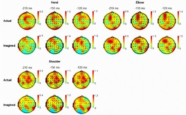 用腦電圖慢皮層電位重建3D空間中的手,肘和肩的實際和想象的軌跡 用腦電圖慢皮層電位重建3D空間中的手,肘和肩的實際和想象的軌跡