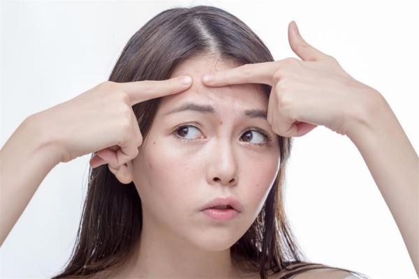 痘痘反覆不見好?可能是2件事沒做好,想要祛痘,3個習慣很重要 痘痘反覆不見好?可能是2件事沒做好,想要祛痘,3個習慣很重要