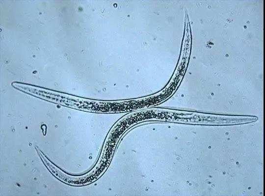 16歲姑娘直腸裡竟有蟲子在蠕動！醫生提醒：家裡有這些的要小心