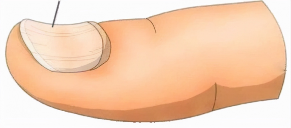 隱藏在指甲上的秘密