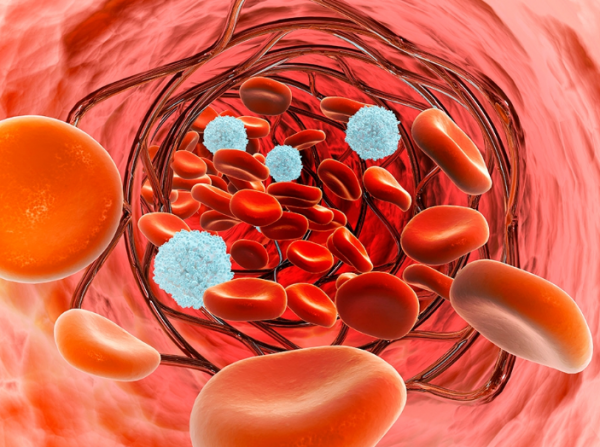 血常規檢查中，如果這3個指標升高，建議做進一步檢查，別大意