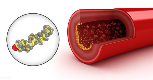 血管堵塞，中醫有什麼方法？