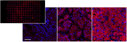 南開學生團隊研發新技術 助癌症患者精準選藥