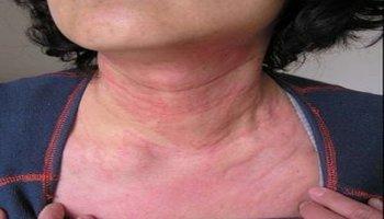 甲減的人,應主動遠離這類魚,看看你猜對了嗎? 甲減的人,應主動遠離這類魚,看看你猜對了嗎?