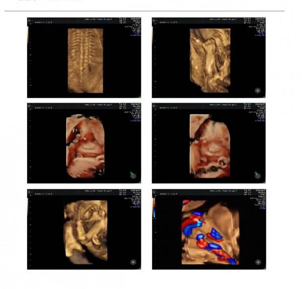 生男生女都一樣