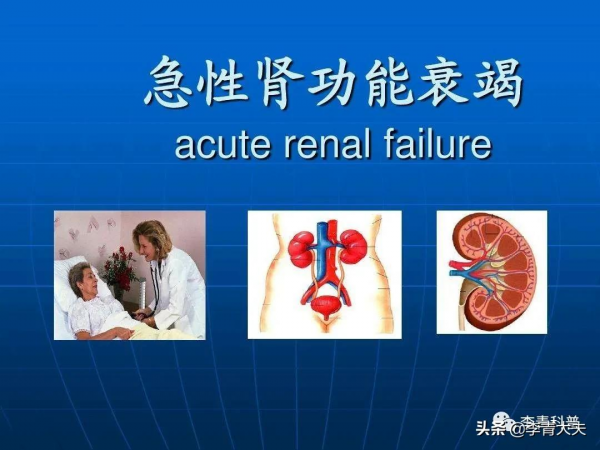 治感冒治出的急性腎衰竭