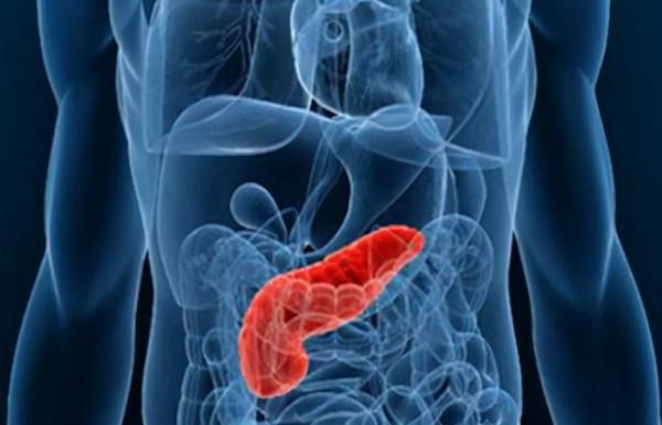 CANCER CELL:臨床M2巨噬細胞相關基因輔助治療胰腺導管腺癌 CANCER CELL:臨床M2巨噬細胞相關基因輔助治療胰腺導管腺癌