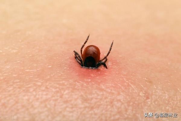 農村哪裡蜱蟲多,被蜱蟲叮咬該怎麼處置,三招可有效預防 農村哪裡蜱蟲多,被蜱蟲叮咬該怎麼處置,三招可有效預防