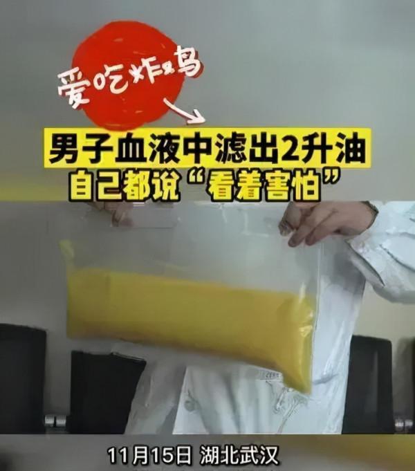 「膽小勿入」減肥預切胃，血中濾出2升油