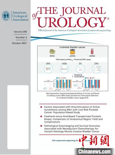 中國專家研發精準檢測試劑盒 實現膀胱癌早期檢測便捷無創