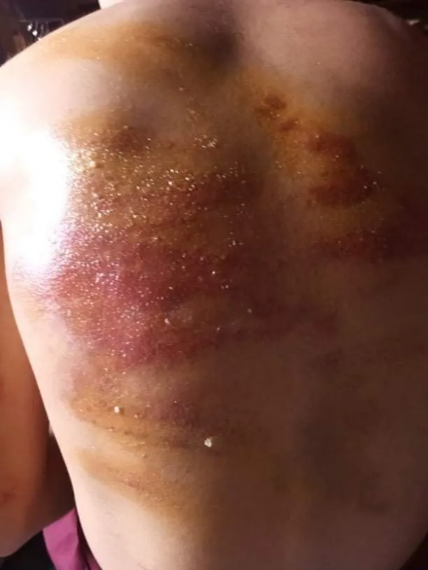 緬甸一寺廟小沙彌偷喝牛奶被打死 緬甸一寺廟小沙彌偷喝牛奶被打死