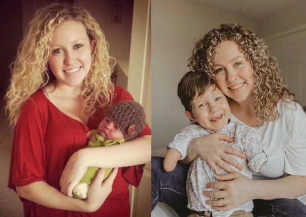 B超嬰兒無四肢,18歲媽媽拒絕墮胎,冒險生子,把孩子養成男子漢 B超嬰兒無四肢,18歲媽媽拒絕墮胎,冒險生子,把孩子養成男子漢