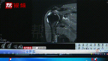 打麻將打到肌腱斷裂？麻將：這個鍋不背