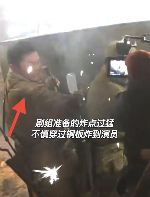 42歲李晨拍戲被炸傷!火藥碎片扎入眼球,受傷後要求重拍嚇壞吳京 42歲李晨拍戲被炸傷!火藥碎片扎入眼球,受傷後要求重拍嚇壞吳京