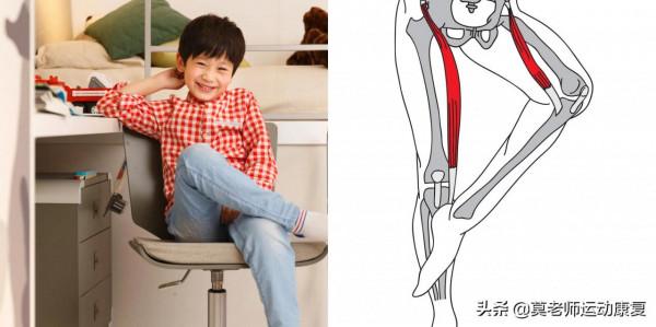 人體最長的肌肉——縫匠肌的運動功能和肌力訓練