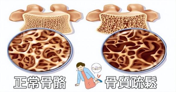 奧美拉唑是飯前吃還是飯後吃？長期服用有什麼影響？聽醫生怎麼說