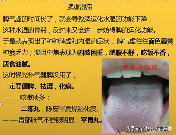 脾氣虛、脾陽虛,這6種脾虛,從初級到嚴重,你是屬於哪一種? 脾氣虛、脾陽虛,這6種脾虛,從初級到嚴重,你是屬於哪一種?
