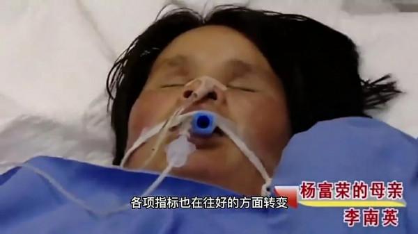 年齡大又有殘疾該不該生三胎