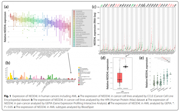 文獻薦讀 | 急性髓細胞白血病NEDD4L表達與基因異常和預後的顯著相關性;男性乳腺癌的職業風險因素 文獻薦讀 | 急性髓細胞白血病NEDD4L表達與基因異常和預後的顯著相關性;男性乳腺癌的職業風險因素